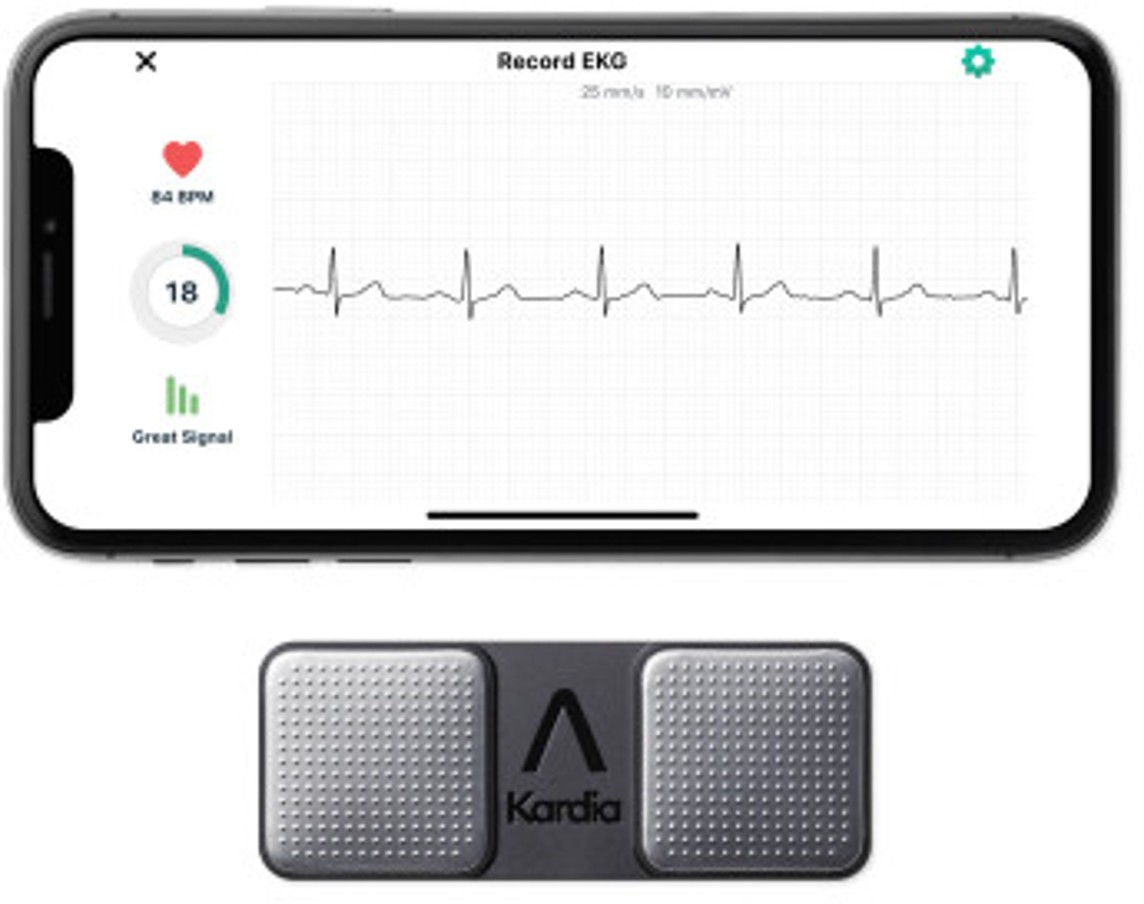 Kardia personal EKG monitor